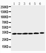 Anti-Cyclin D1/CCND1 Antibody Picoband® Boster Bio