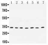 Anti-Cyclin D1/CCND1 Antibody Picoband® Boster Bio