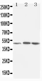 Anti-LXR alpha/NR1H3 Antibody Picoband® Boster Bio