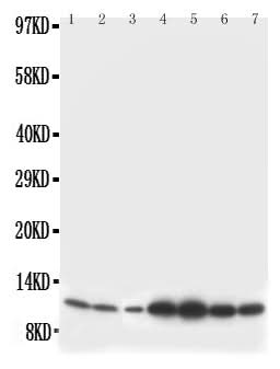 Anti-S100 beta/S100B Antibody Picoband® Boster Bio