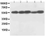Anti-Caspase-8 (P18)/CASP8 Antibody Picoband® Boster Bio