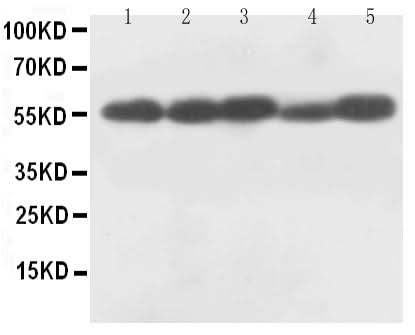 Anti-Caspase-8 (P18)/CASP8 Antibody Picoband® Boster Bio