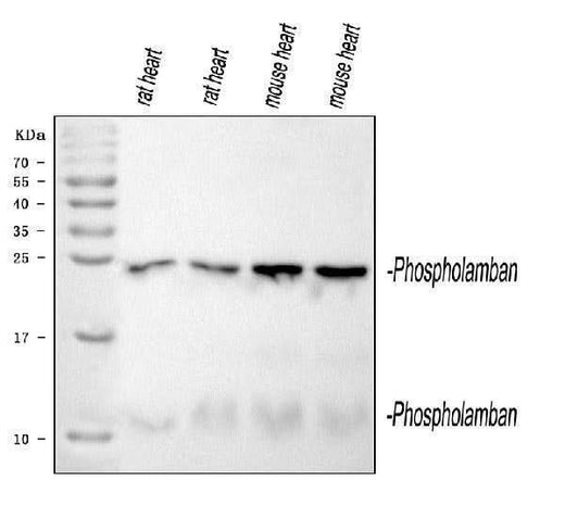 Anti-Phospholamban/PLN Antibody Picoband® Boster Bio