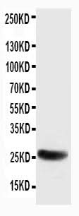 Anti-SNAP25 Antibody Picoband® Boster Bio