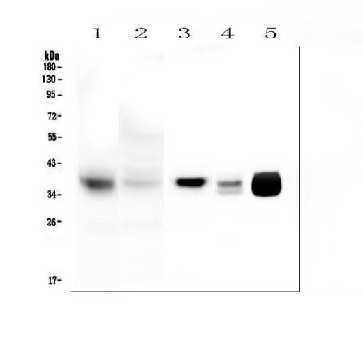 Anti-MTCO1/MT-CO1 Antibody Picoband® Boster Bio