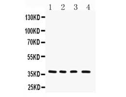 Anti-MTCO1/MT-CO1 Antibody Picoband® Boster Bio