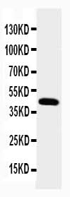 Anti-Podocin NPHS2 Antibody Picoband® Boster Bio