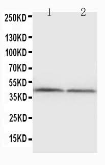 Anti-Podocin NPHS2 Antibody Picoband® Boster Bio