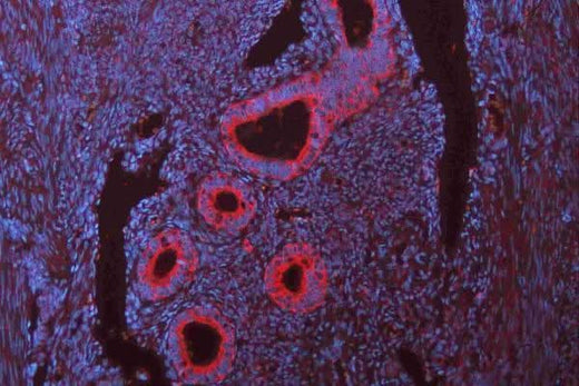 Anti-N-Cadherin-2 CDH2 CD325-Antibody Picoband® Boster Bio