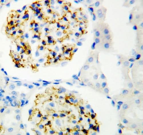 Anti-CD34 Antibody Picoband® Boster Bio