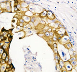 Anti-Cytokeratin 19/KRT19 Antibody Picoband® Boster Bio