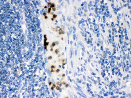 Anti-Cardiac FABP/FABP3 Antibody Picoband® Boster Bio