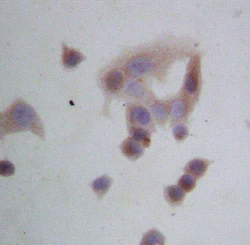 Anti-GRP94/HSP90B1 Antibody Picoband® Boster Bio
