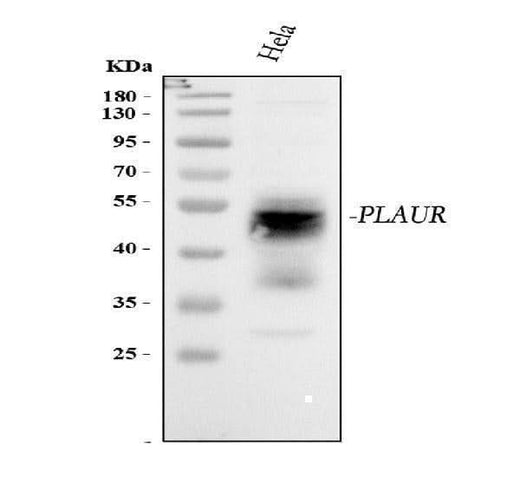 Anti-uPA Receptor/PLAUR Antibody Picoband® Boster Bio