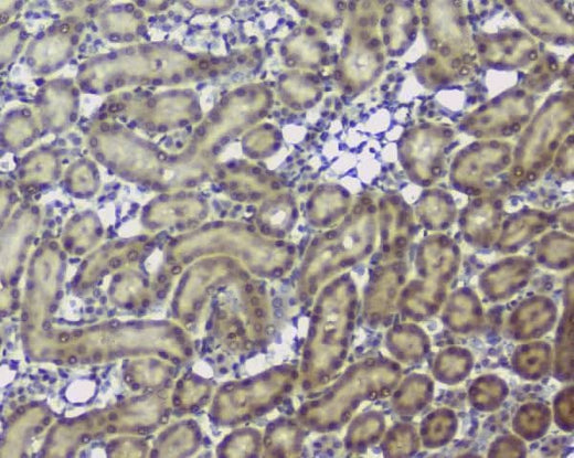 Anti-Superoxide Dismutase 1/SOD1 Antibody Picoband® Boster Bio
