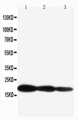 Anti-IL1 beta/IL1B Antibody Picoband® Boster Bio
