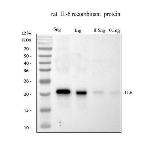 Anti-Interleukin-6 IL6 Antibody Picoband® Boster Bio