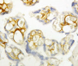 Anti-P-Cadherin-3 CDH3-Antibody Picoband® Boster Bio