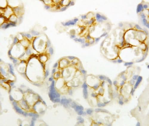 Anti-P-Cadherin-3 CDH3-Antibody Picoband® Boster Bio