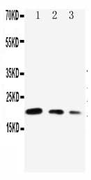 Anti-CDC42 Antibody Picoband® Boster Bio