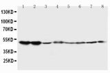 Anti-5HT2A Receptor/HTR2A Antibody Picoband® Boster Bio