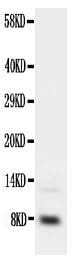 Anti-Insulin-like growth factor I IGF1 Antibody Picoband® Boster Bio