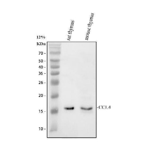 Anti-Macrophage Inflammatory Protein 1 beta/CCL4 Antibody Picoband® Boster Bio