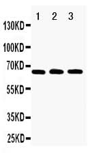 Anti-RANK/TNFRSF11A Antibody Picoband® Boster Bio