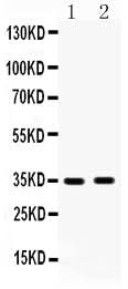 Anti-HSD17B6 Antibody Picoband® Boster Bio