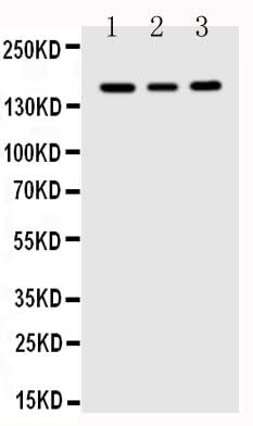 Anti-VEGF Receptor 1/FLT1 Antibody Picoband® Boster Bio