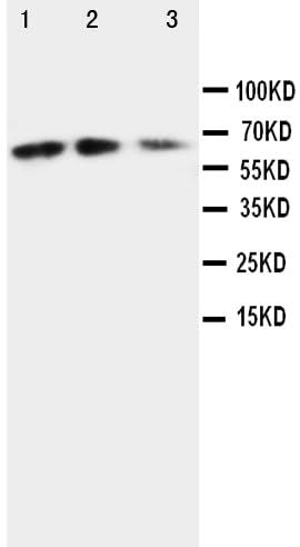 Anti-Fractalkine CX3CL1 Antibody Picoband® Boster Bio