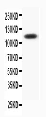 Anti-Progesterone Receptor/PGR Antibody Picoband® Boster Bio