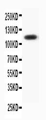 Anti-Progesterone Receptor/PGR Antibody Picoband® Boster Bio