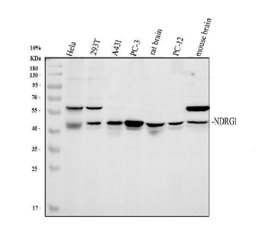 Anti-Protein NDRG1 NDRG1 Antibody Picoband® Boster Bio