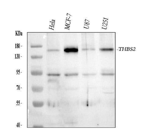 Anti-Thrombospondin 2/THBS2 Antibody Picoband® Boster Bio