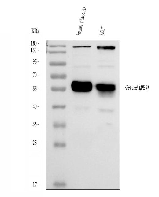 Anti-Alpha-2-HS-glycoprotein AHSG Antibody Picoband® Boster Bio