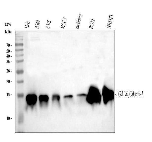 Anti-Galectin 1/LGALS1 Antibody Picoband® Boster Bio