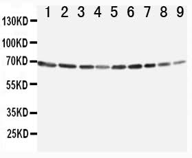 Anti-Annexin VI/ANXA6 Antibody Picoband® Boster Bio