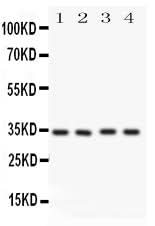 Anti-Caspase-7(P11)/CASP7 Antibody Picoband® Boster Bio