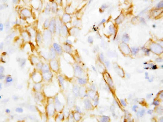 Anti-beta Defensin 1/DEFB1 Antibody Picoband® Boster Bio