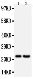 Anti-Fibroblast growth factor 9 FGF9 Antibody Picoband® Boster Bio