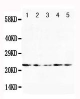 Anti-Fibroblast growth factor 10 FGF10 Antibody Picoband® Boster Bio