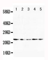 Anti-Fibroblast growth factor 10 FGF10 Antibody Picoband® Boster Bio