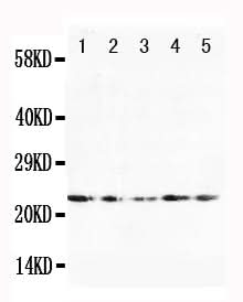 Anti-Fibroblast growth factor 10 FGF10 Antibody Picoband® Boster Bio