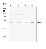 Anti-Fibroblast growth factor 22 FGF22 Antibody Picoband® Boster Bio