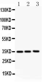 Anti-GM-CSF/CSF2 Antibody Picoband® Boster Bio