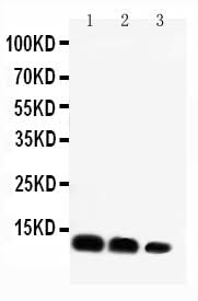 Anti-C-X-C motif chemokine 16 CXCL16 Antibody Picoband® Boster Bio