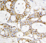 Anti-Lipoamide Dehydrogenase/DLD Antibody Picoband® Boster Bio