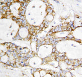 Anti-Lipoamide Dehydrogenase/DLD Antibody Picoband® Boster Bio