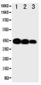 Anti-IL12 p40/IL12B Antibody Picoband® Boster Bio